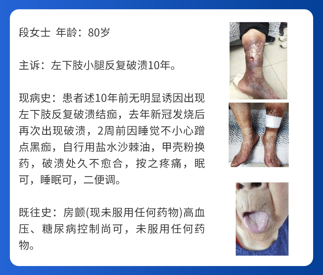 【北(běi)京市(shì)中西(xī)醫(yī)結合周圍血管疑難病會(huì)診中心】第三期會(huì)診(圖6)