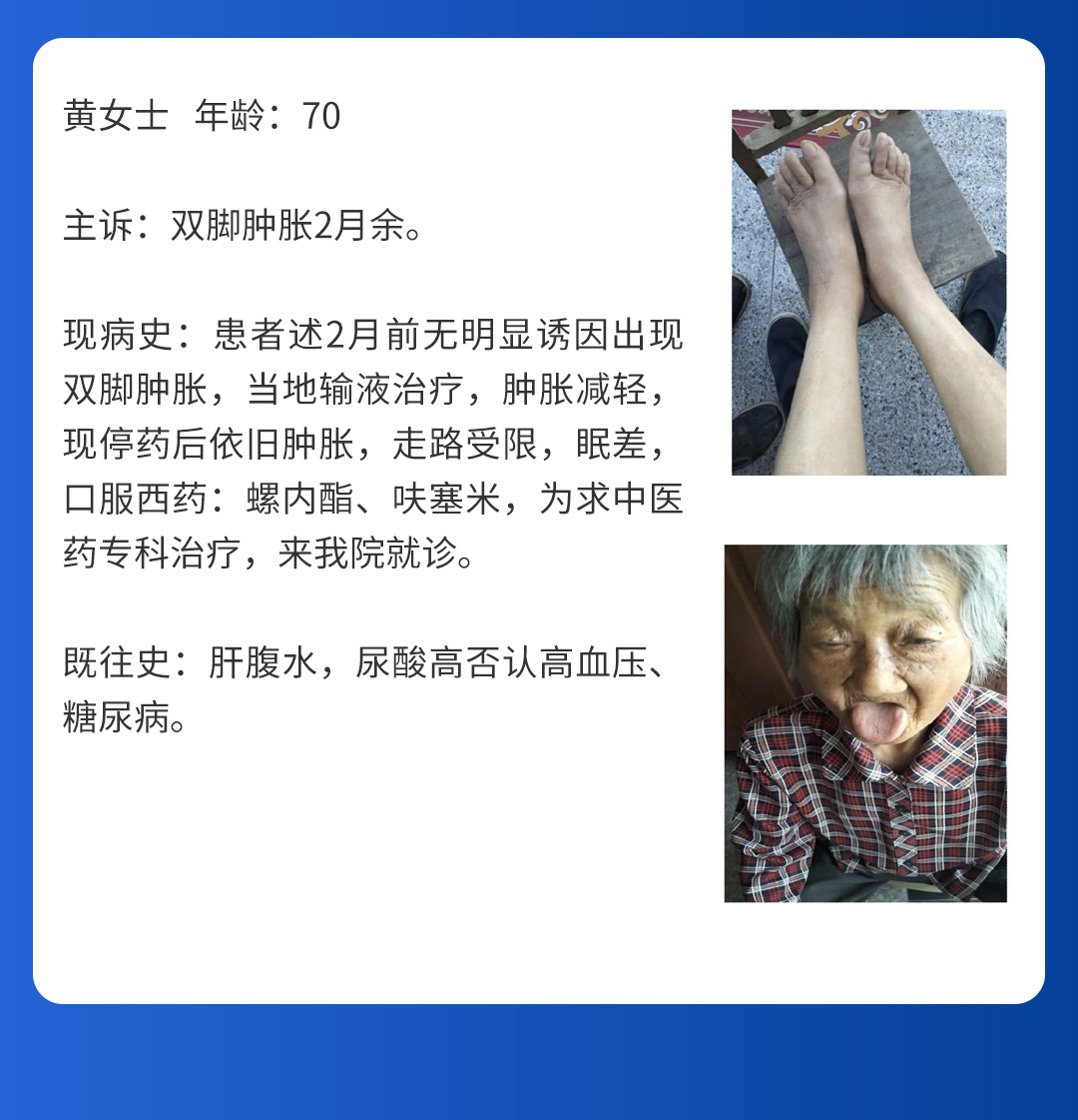 【北(běi)京市(shì)中西(xī)醫(yī)結合周圍血管疑難病會(huì)診中心】第三期會(huì)診(圖7)