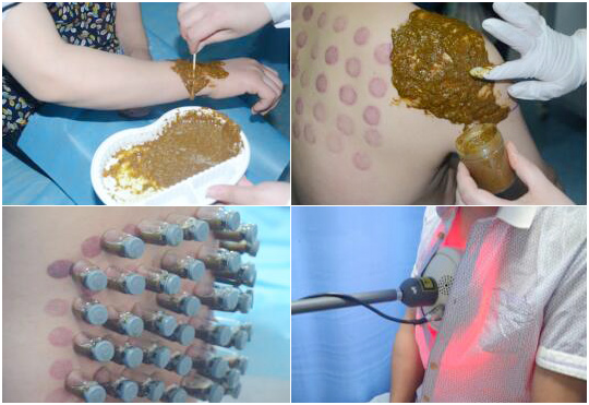 北京京醫中醫醫院（有限合夥）：向中醫(yī)藥看(kàn)齊，與世界共享中醫(yī)藥文(wén)化(huà)(圖4)